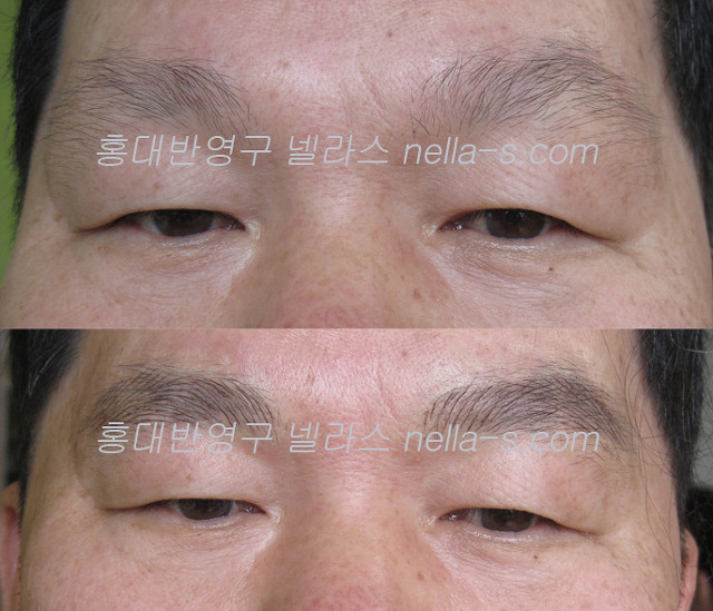 넬라스 이미지