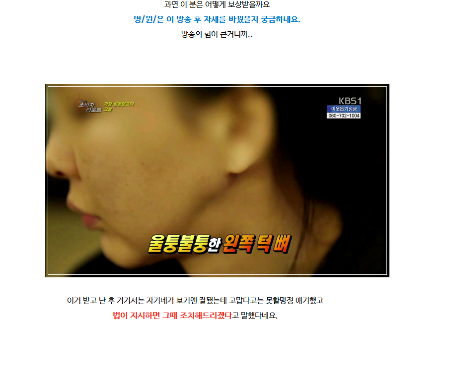 성형 과장광고 & 전후사진 모두 보정가짜 속지맙시다.jpg | 인스티즈