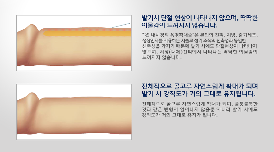 퍼스트비뇨기과 이미지