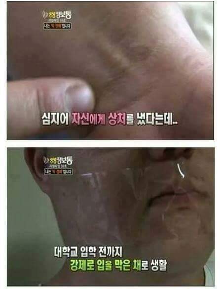 나는 틱 장애인입니다 홍기호씨를 아십니까? | 인스티즈
