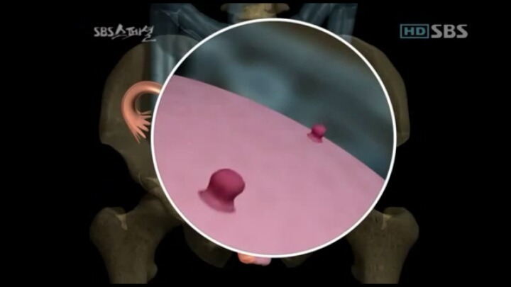 생리통의 원인 | 인스티즈