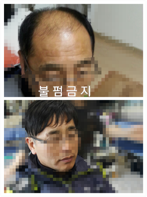 현담가발 이미지