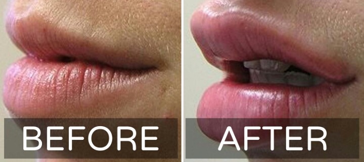 서양권에서 많이하는 성형수술 세개 | 인스티즈