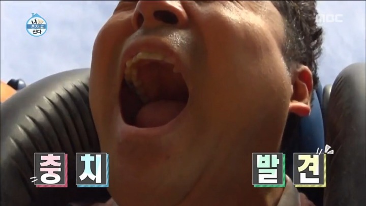 [나혼자산다] 전현무 충치치료.jpg | 인스티즈