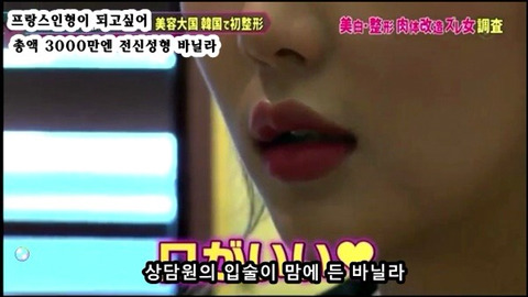 프랑스 인형이 되고싶어 총액 3000만엔 전신성형한 바닐라 | 인스티즈