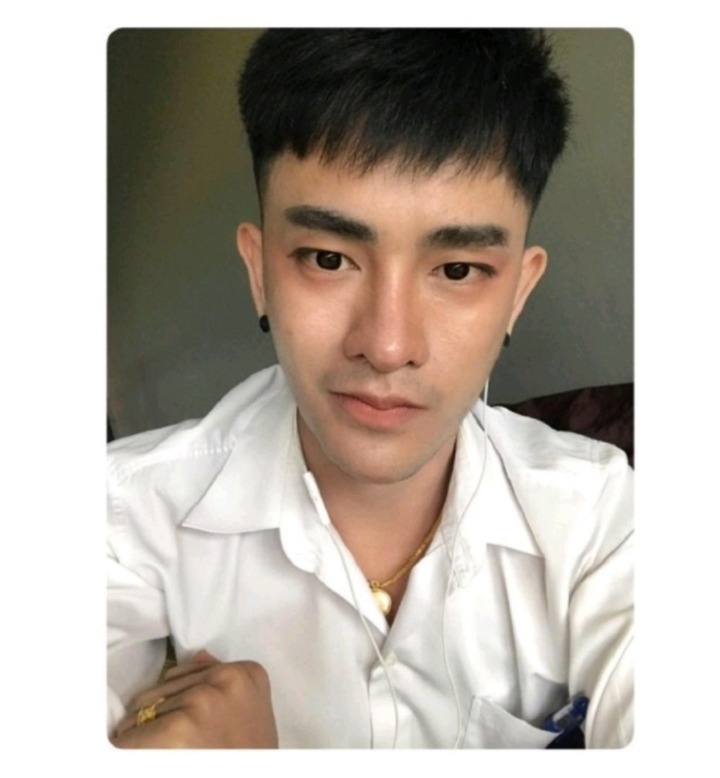30번 성형한 태국 남자 | 인스티즈