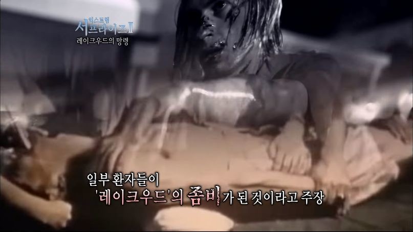 [서프라이즈] 잘못된 수술 레이크우드의 망령.jpg | 인스티즈