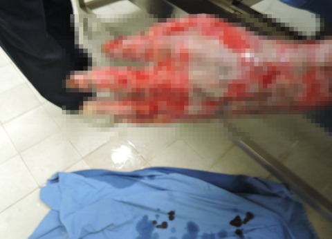 안녕하세요 저는 자주포사고 부상자 이찬호입니다. (사진 꼭 주의하고 들어와) | 인스티즈